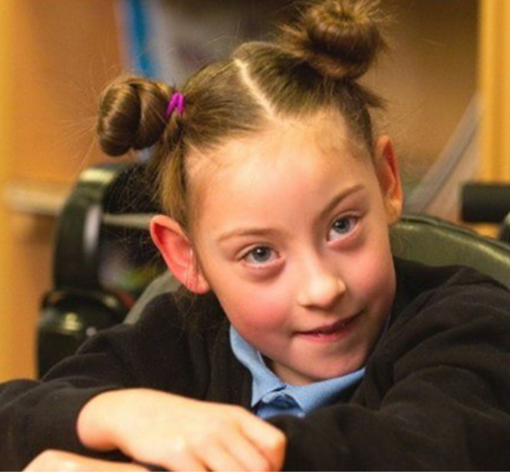 Conditions Cerebral Palsy